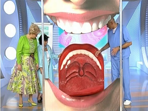 Флегмона полости рта и ее лечение