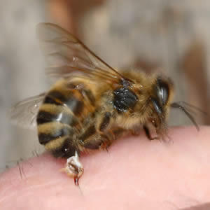 Лечение рассеянного склероза пчелами - советы