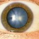 Народное лечение катаракты