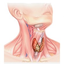 Онкология. Рак щитовидной железы