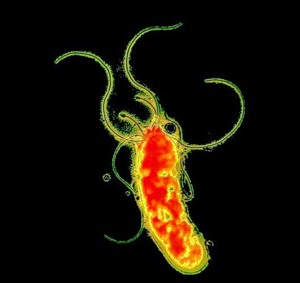 Роль бактерии при гастрите. Helicobacter pylori