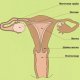 Воспаление органов таза у женщин