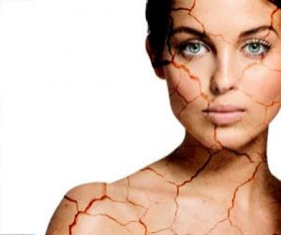 Трещины на коже: причины появления и методы лечения
