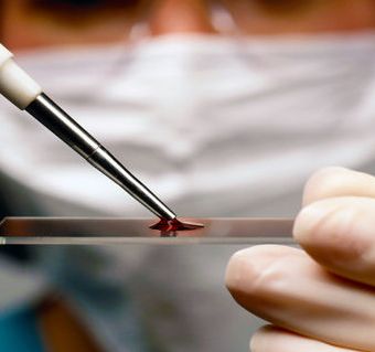 Анализы крови в лаборатории и их расшифровка