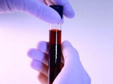 Расшифровка биохимического анализа крови ребенка