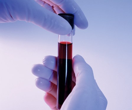 Что определяет анализ крови