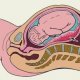 Отслойка плаценты при беременности