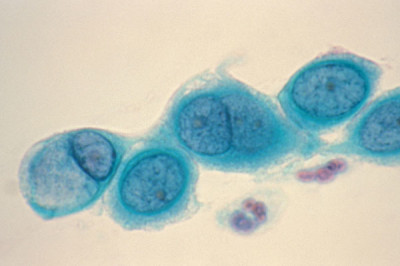 Chlamydia-trachomatis