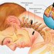 Симптомы остеохондроза шейного отдела, причины и особенности