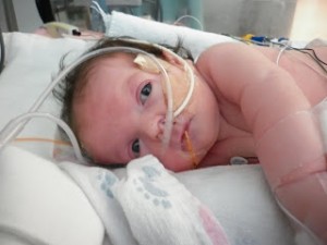 Новорожденным пациентам лечение проводится с помощью пенициллина