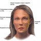 Неврит лицевого нерва и его этиологическое лечение