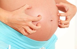 Зуд при беременности: в чем причина и как его лечить? 