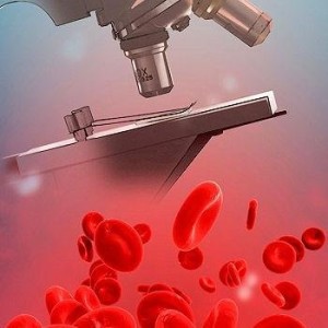 Виды анализов крови: о чем расскажут клинические исследования?
