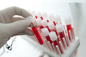 В современной медицинской практике общий анализ крови представляет собой самую распространенную процедуру