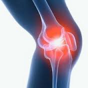 Посттравматический артрит коленного сустава