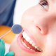 Шинирование зубов: особенности методов и процедуры