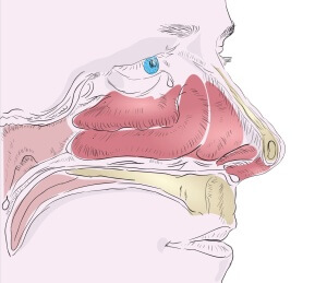 Вазомоторный ринит - это нарушение носового дыхания, вследствие сужения полости носа из-за отека слизистых оболочек