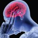 Нарушение мозгового кровообращения: почему возникает и чем чревато