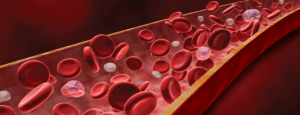 Полицитемия - повышение уровня красных кровяных телец в крови