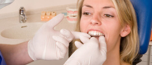 Пациентам будет достаточно легко адаптироваться к этим удобным пластинкам, так как капы максимально плотно прилегают к зубам