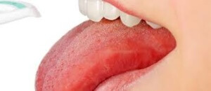 Онемение губ и языка может быть следствием стоматологических процедур