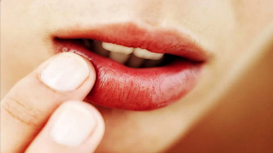 Аллергия на губах: причины, симптоматика, лечение