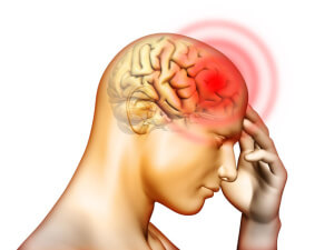 Одним из симптомов синусита является сильная головная боль