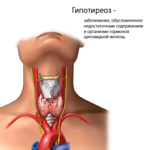 Препарат назначается пригипотериозе щитовидной железы