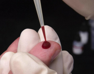 Определить повышение количества этих кровяных телец можно с помощью анализа крови