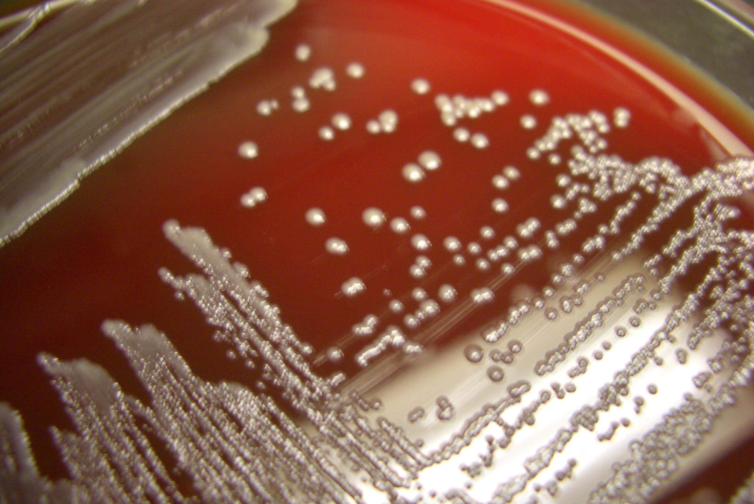 Коринебактерии: особенности микроорганизмов