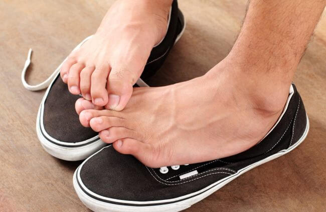 Потница на ногах: причины, симптомы, лечение