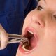 Что делать, если после удаления зуба опухла десна