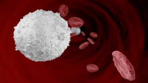 Лейкоплазмоз - значительное повышение количества лейкоцитов в пробе