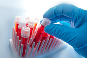 Анемия - понижения уровня гемоглобина в крови