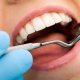 Ретинированный зуб: что это и чем опасно