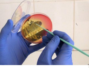 Наличие патологической бактерии в мазке - повод начать лечение