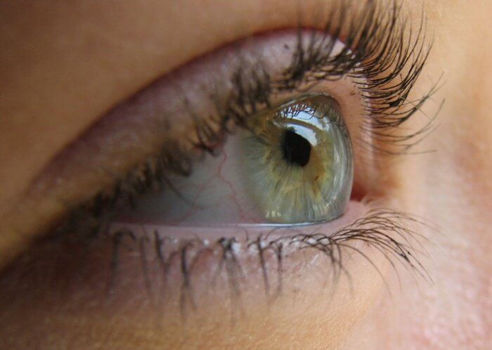Помутнение роговицы: лечение глазной патологии