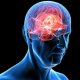 Симптомы и лечение легкого сотрясения мозга