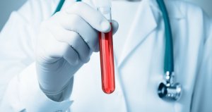 В общем анализе крови повышенное содержание лейкоцитов