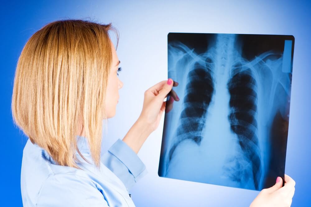 Основные симптомы туберкулеза легких на ранних стадиях