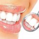 Установка зубных имплантов: отзывы пациентов, преимущества и недостатки