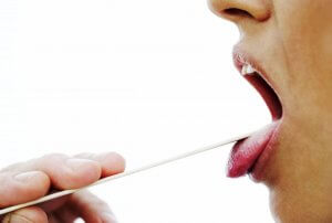 Причины кровотечения изо рта
