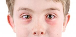 Осложнения у детей после этмоидита