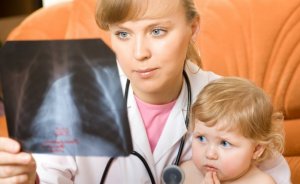 Степени тяжести пневмонии в детском возрасте