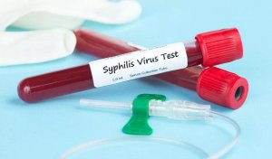 Исследование крови для выявления сифилиса