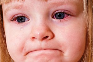 Глазные болезни у детей